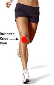 What Is Runner's Knee? Signs, Symptoms And Rehab Guide | By Alina Kennedy |  Medium