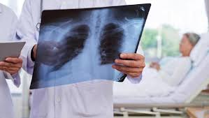 Vpn adalah alat atau tool keamanan yang penting untuk melindungi privasi online anda. Apa Itu Pneumonia Begini Penjelasannya