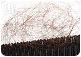 Because of the balancing effects of progesterone and its protective effect on breast tissue, postmenopausal women who have had a hysterectomy and are on estrogen therapy should also receive this hormone. What Is The Impact Of Bioidentical Hormones On Hair Loss Shecares
