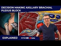 Image result for Axillary Nerve Block