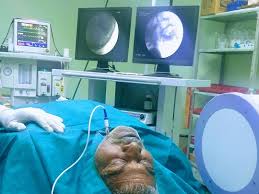 Image result for Radiofrequency Surgery