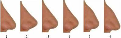 Maybe you would like to learn more about one of these? Effects Of Different Nose Types On Class Ii Treatments For Female Patients Progress In Orthodontics Full Text