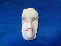 Cryosurgery, which freezes and destroys unwanted or abnormal tissues. How To Remove Nose Skin Excess Aesthetically Reasonable Approach