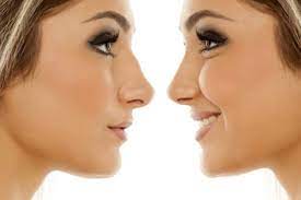For jobs in some industries, it can be a good idea to try during their main hiring season. Rhinoplasty In Korea Procedure Recovery Cost In Korea Answer Plastic Surgery