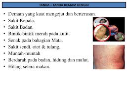 Badan terasa ngilu dan demam ini menandakan tanda pendarahan. Ppt Penyakit Demam Denggi Powerpoint Presentation Free Download Id 4265349