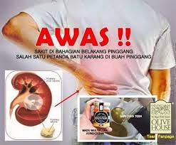 Bila dah dapat result doc confirm babah ada batu karang, satu kat hempedu, satu kat buah pinggang. Batu Karang Di Buah Pinggang Olive House Kuantan Facebook