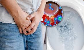 Prostate cancer can spread to other areas of the body through the lymph nodes and bloodstream, sometimes causing a block in the lymphatic system. Signs Of Prostate Cancer You May Be Ignoring How Fast Is Your Urine Stream Sound Health And Lasting Wealth