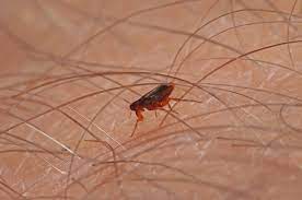 Sebenarnya, bekas gigitan nyamuk pada kulit bayi akan menghilang dengan sendirinya, sebab kulit bayi akan terus mengalami regenerasi sel. Gigitan Kutu Bisa Tahan Bertahun Tahun