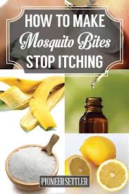 15 Home Remedies For Mosquito Bites That Itch Homesteading Remedies For Mosquito Bites Natural Home Remedies Health Remedies