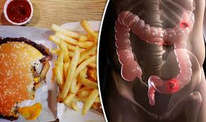 But, things called risk factors can increase the chance of a person developing it. Bowel Cancer Cause Western High Meat Fatty Diet Causes Tumours To Grow Express Co Uk