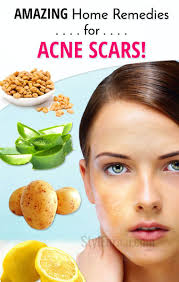 Pin On For A Healthy Living