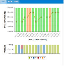 chart legend not showing if chart is an object in extjs