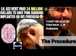 Rapper lil uzi vert got a $24million pink diamond pierced onto his forehead, sharing with his bewildered fans that he had been paying for the large stone since 2017. 4tua Zwfq9c86m