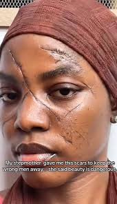 Anastasiya has been left with a permanent scar