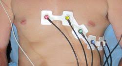 Kardía, deutsch ‚herz', und γράμμα. Rapid Pad Ekg 12 Ableitungselektroden Mp Moeri Paramedic