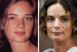We talk to a woman who had a nose job to find out what it's really like to get plastic surgery. Gabriele Anwar Plastic Surgery Scandal