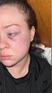 Importance of Kindness and Understanding in Dealing with Mental Health  Issues