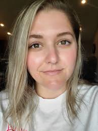 ISO Advise: Right as my menstrual cycle is about to start, my face gets  red, I get dry patches as my scalp gets dry. This time around it's so bad  and the