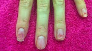 See more ideas about best acrylic nails, nails, cute acrylic nails. 8 Great Tips To Repair Nails After Acrylics Nails After Acrylics Damaged Nails Nail Repair