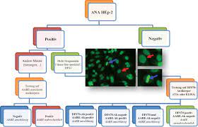 Dfs70 Antikorper Biomarker Zum Ausschluss Ana Assoziierter Rheumatischer Erkrankungen
