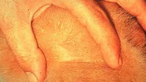 Image result for what do Cheyletiella look like in dog fur