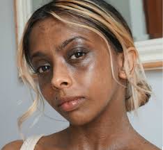 Why I Ve Used Skin Whitening Products Bbc News Fair & lovely fairness soap: bbc