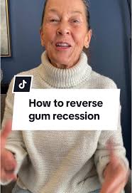 How to Reverse Gum Recession Effectively