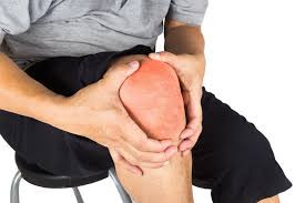 Image result for gout symptoms knee