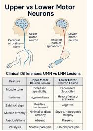Image result for Neurologic Lesion Localization