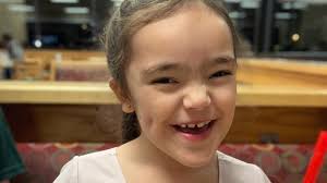 Molly's Kids: Aurora Jayne has a syndrome you probably can't pronounce