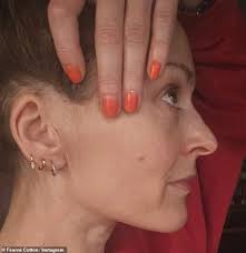 Fearne Cotton shares health update after undergoing surgery to remove two  tumours