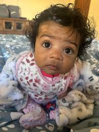 Parents Choice baby wipes causing orange discoloration?