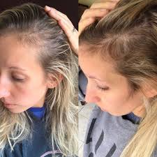 It's still the most common cause of mental retardation in children, says liao. What Are The Best Hairstyles For Very Thin Hair Hair Adviser