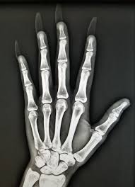 Pin On X Rays
