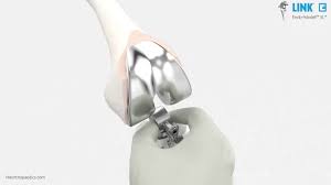 Over 150000 repairable vehicles or vehicles for parts at copart. Link Knie