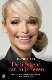 De Littekens Van Mijn Leven Boeken Boeken Lezen Waargebeurde Verhalen