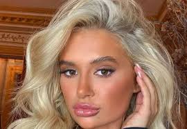 Molly Mae reveals huge birthmark in throwback baby pic