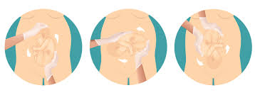 Image result for External Cephalic Version