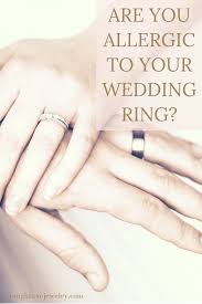 Are You Allergic To Your Wedding Ring Vintage Style Engagement Rings Buying An Engagement Ring Rings