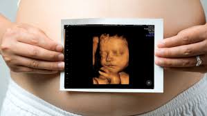 For many parents, being able to see their unborn child in such granular detail is an exciting once in a lifetime experience. Top 3d 4d Ultrasound Places In Adelaide Kiddo Mag