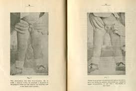 Case Of Maria Lucia P As Observed By Jose Bacalhau In 1945 Source Download Scientific Diagram Essa ocorrência é impossível nos seres humanos, pois o hermafrodita verdadeiro é estéril. bacalhau in 1945 source