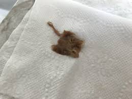 Image result for Retained Placenta