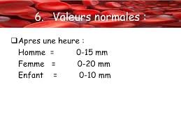Elle est étudié dan un tube vertical, long et étroit. La Vitesse De Sedimentation Methode De Westergren