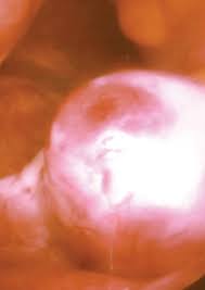But women become less fertile as they get older. Ovulation Wikipedia