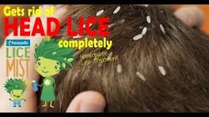Check spelling or type a new. How To Check For Lice And Nits 3 Step Video Procedure