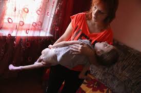 The chernobyl accident led to a sharp increase in the number of children who were born already deformed, genetically mutated, which. Birth Defects Related To Chernobyl