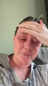 Dupixent Commercial Bike