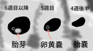 採卵9回→モザイク移植→出産（45歳） - はてなブログ