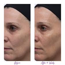 Best Eye Cream for Dark Circles Eyebrations Triple Action Eye Serum