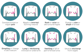 According to the susan g. Breast Cancer Symptoms Learn The Signs Young Survival Coalition